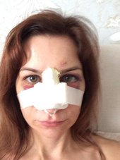 В Красноярске избили "Медиаперсону года" Наталью Сипетую